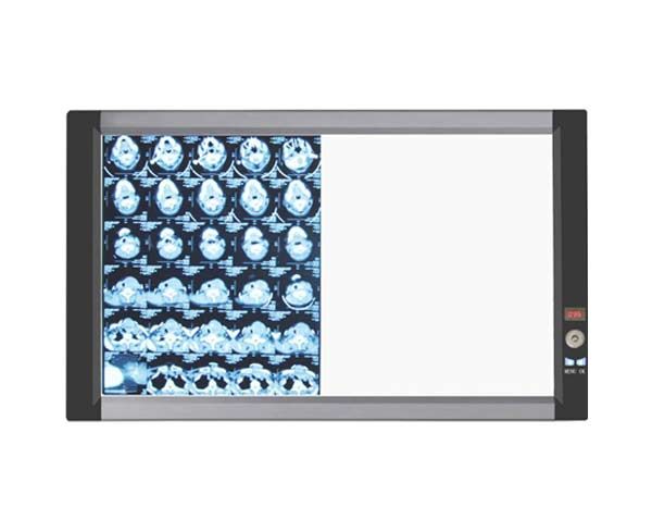 small4_15498778766332044